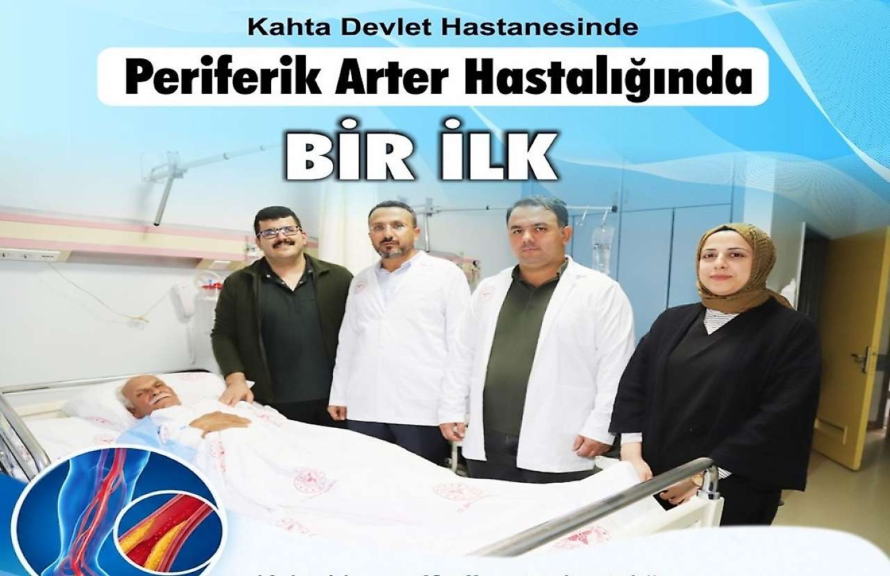Kahta Devlet Hastanesinde Bacak Damarlarının tedavisinde bir ilk