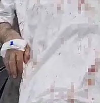 Şanlıurfa'da 72 yaşındaki adamı öldüresiye döven 4 şüpheli tutuklandı