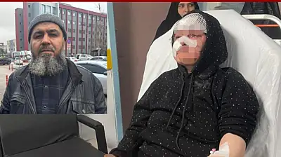 Boşanmak isteyen kadın eşi tarafından öldüresiye darp edildi