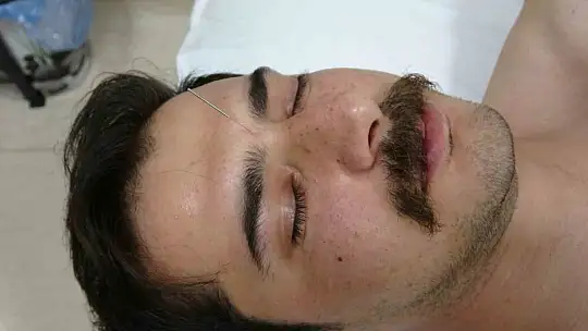 Akupunktur tedavisiyle sağlıklarına kavuştular