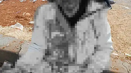 Boşanmak isteyen kadın eşi tarafından öldüresiye darp edildi