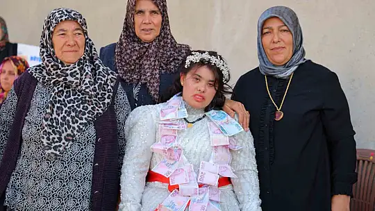 Down sendromlu Melek'in gelinlik hayali gerçek oldu