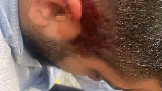 Elektrik personeline saldırı, kaçak trafodan hayatını kaybetti