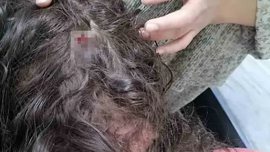 Gaziantep'te iki kız çocuğunu öldüresiye döven sanıklara 15 yıla kadar hapis talebi