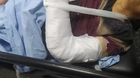 Gaziantep'te özel hastanenin yoğun bakım ünitesinde şiddet iddiası
