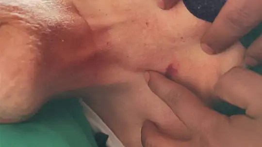 Gaziantep'te özel hastanenin yoğun bakım ünitesinde şiddet iddiası