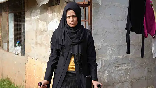 Kahramanmaraş merkezli büyük depremde bacağını kaybetti, eşi terk etti