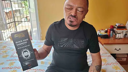 Saçlarını siyahlatmak için aldığı şampuan arı sokmasından beter hale getirdi