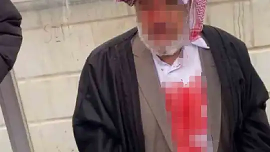 Şanlıurfa'da 72 yaşındaki adamı öldüresiye döven 4 şüpheli tutuklandı