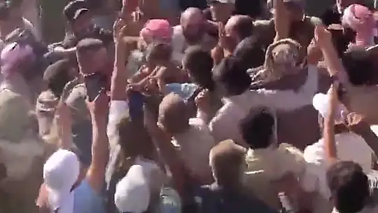 Suriye'de kuyuya düşen çocuk kurtarılarak tedavi için Şanlıurfa'ya getirildi