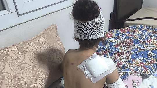 Suruç'ta başıboş köpekler 8 yaşındaki çocuğa saldırdı