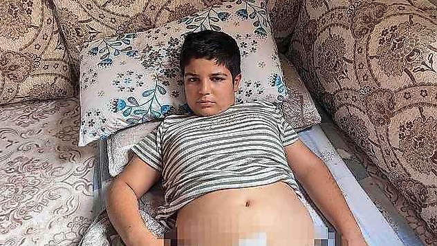 Sokak köpeklerinin saldırdığı çocuk dehşet dolu anlar yaşadı