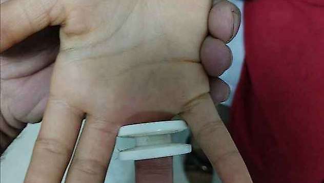 Parmağına plastik parçası sıkışan çocuğu itfaiye kurtardı