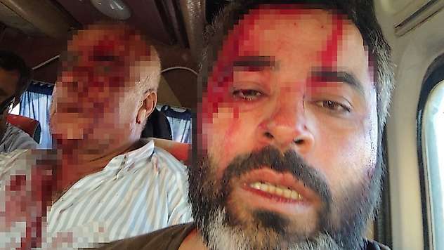 Akçakale'de meydan savaşı gibi kavga: 8 yaralı