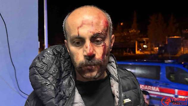 Şanlıurfa'da müvekkilinin yanına giden avukata darp iddiası