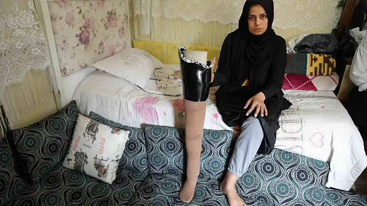 Kahramanmaraş merkezli büyük depremde bacağını kaybetti, eşi terk etti