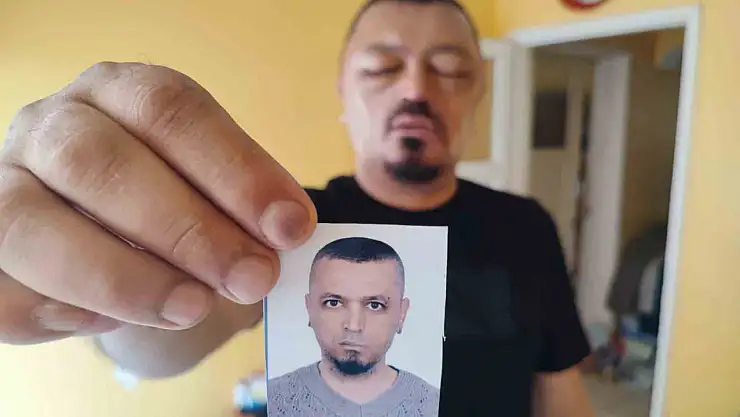 Saçlarını siyahlatmak için aldığı şampuan arı sokmasından beter hale getirdi