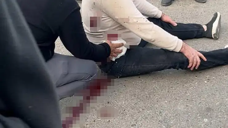 Şanlıurfa'da bıçaklı kavga: 1 yaralı