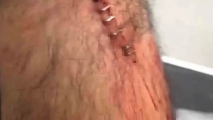 Şanlıurfa'da görev yapan öğretmene sokak ortasında jiletli saldırı