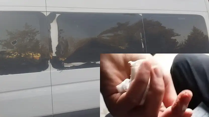 Kahta 02 spor taraftarına çirkin saldırı