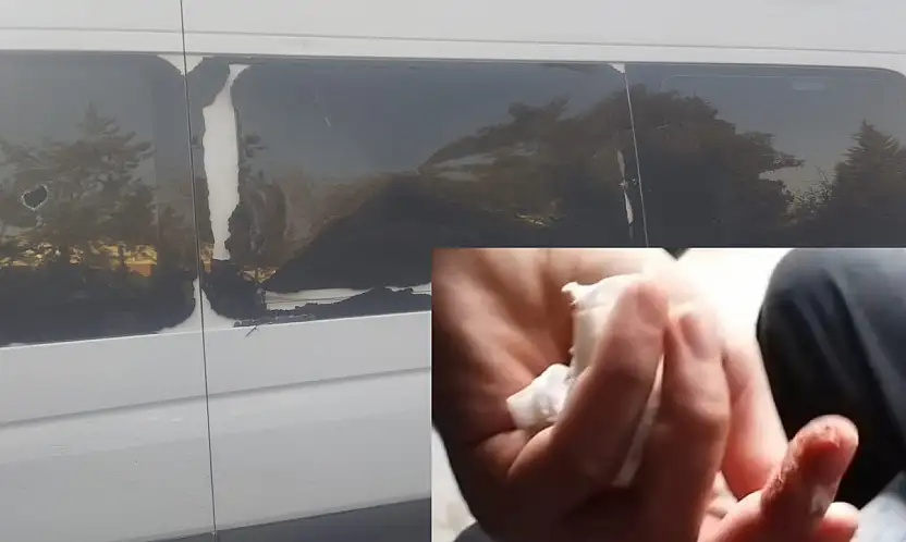 Kahta 02 spor taraftarına çirkin saldırı